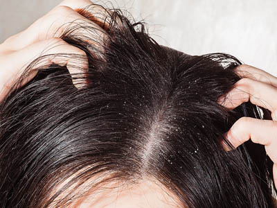 Q. My scalp is really sore and I am now suffering with hair loss. Is there anything you could recommend?